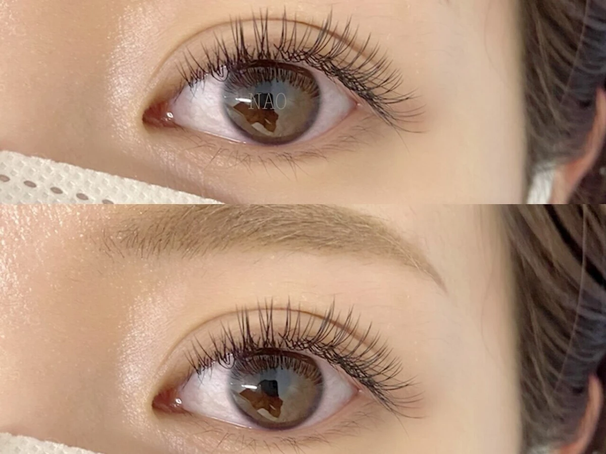 ナチュラルeye 120本コース